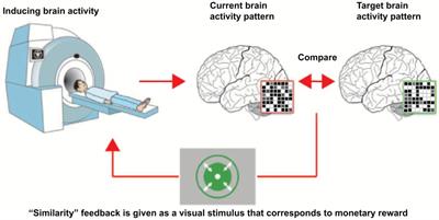 Possible Mechanisms Underlying Neurological Post-COVID Symptoms and Neurofeedback as a Potential Therapy